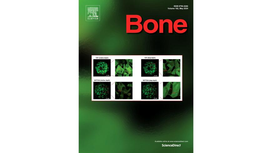 La copertina della rivista Bone